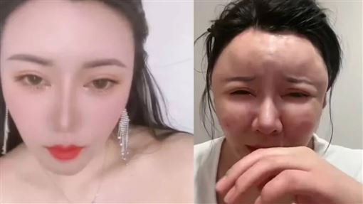 正妹打生長因子想變美！臉饅化慘成面具人