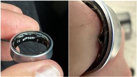 英國科技網紅洛塔，因為配戴的三星智慧戒指電池膨脹，導致戒指卡在他的手指上。（翻攝自X@ZONEofTECH）