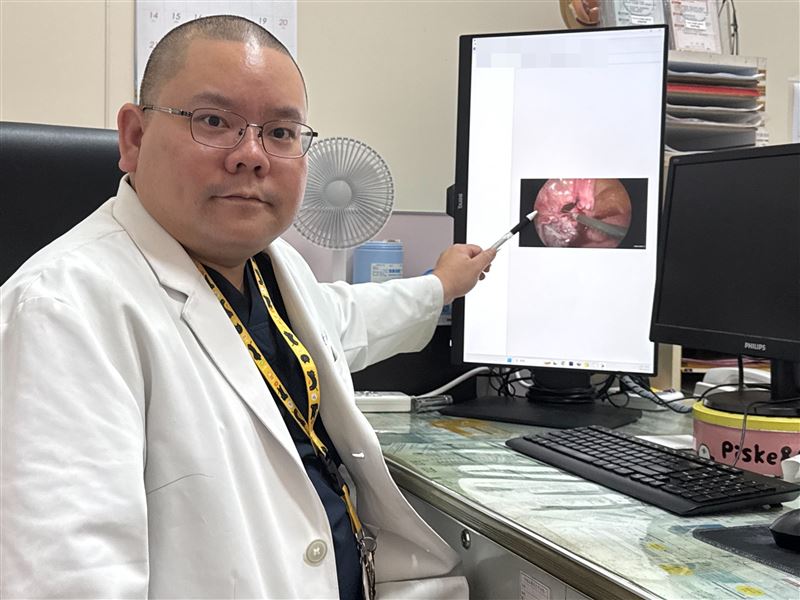 男子酗酒長達15年以上，膀胱嚴重纖維化，某日小便時突然破裂。（圖／大甲李綜合醫院提供）
