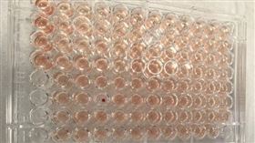 廣東順德，發現首例「鑽石血」， Jk（a-b-）血型，比熊貓血恐龍且稀有百倍(圖／翻攝自順德區中心血站)