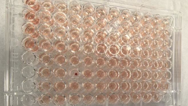 首例「鑽石血」藏廣東　比熊貓血稀有百倍