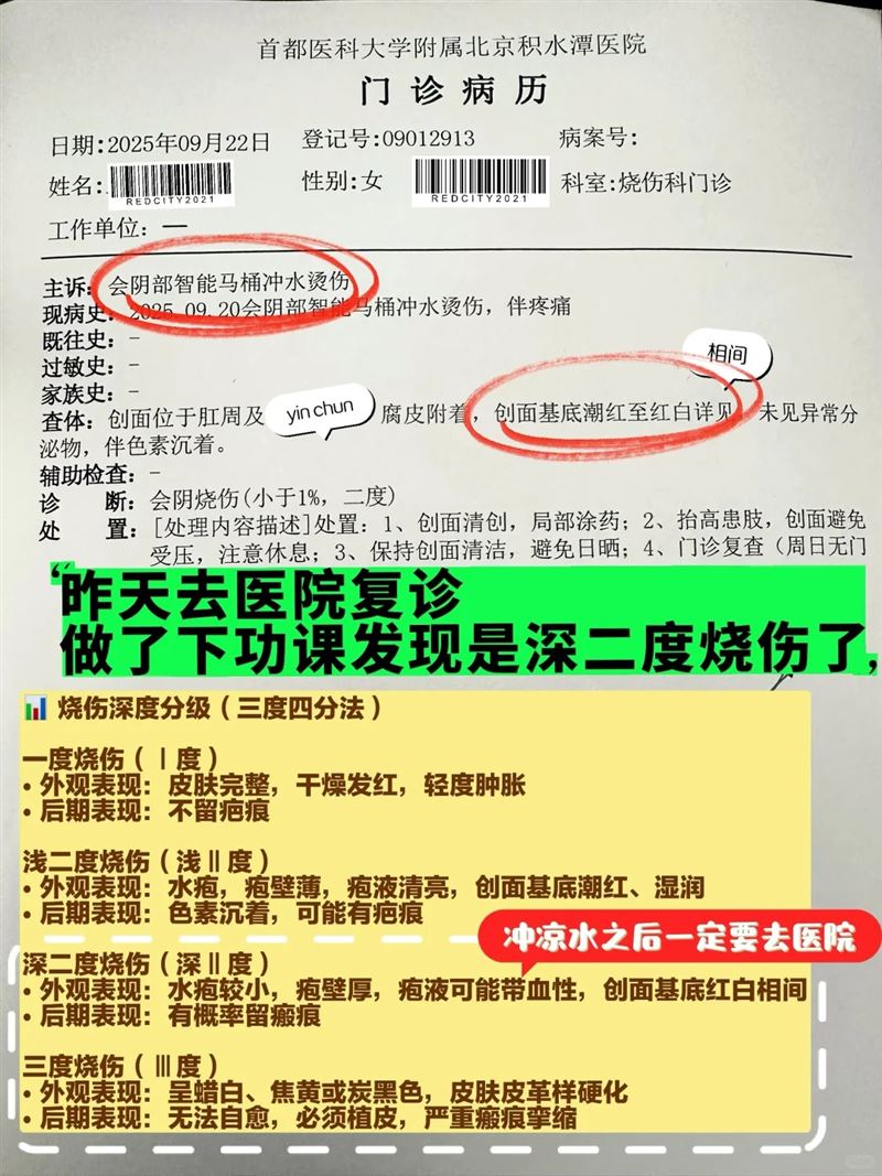 中國女子使用免治馬桶時，遭高溫熱水燙傷，會陰二度燒傷。（圖／翻攝自小紅書）