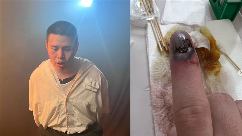 閩南狼驚傳出事了！手遭夾斷「發黑潰爛」