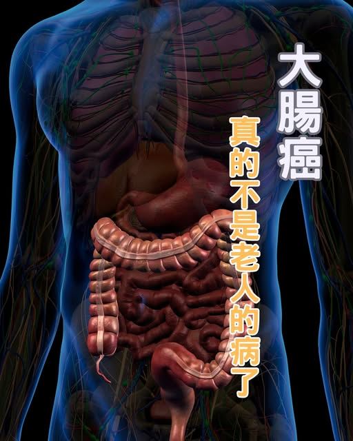 醫師陳保中表示，大腸癌患者年輕化，已非老人才會罹患的疾病。(圖/取自陳保中的臉書)