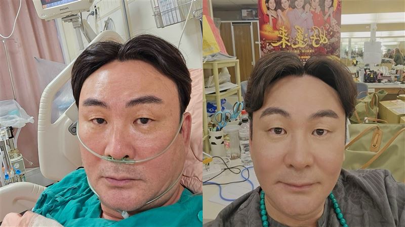 本土男星出事了！驚傳爆肝急送加護病房