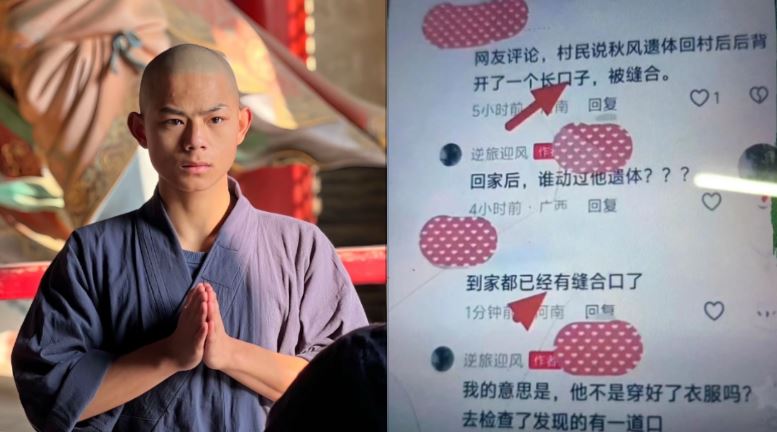 另一名網紅「秋風」（左）於2024年8月在浙江因車禍喪命，網路卻流傳他遺體出現縫合痕跡，疑似遭「器官摘除」。（圖／翻攝自微博）