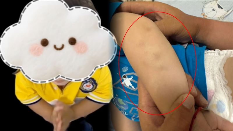 幼兒園以不會留下明顯傷痕虐童，又專挑監視器死角處行刑，家長難以察覺，也死無對證。（圖／家長提供）