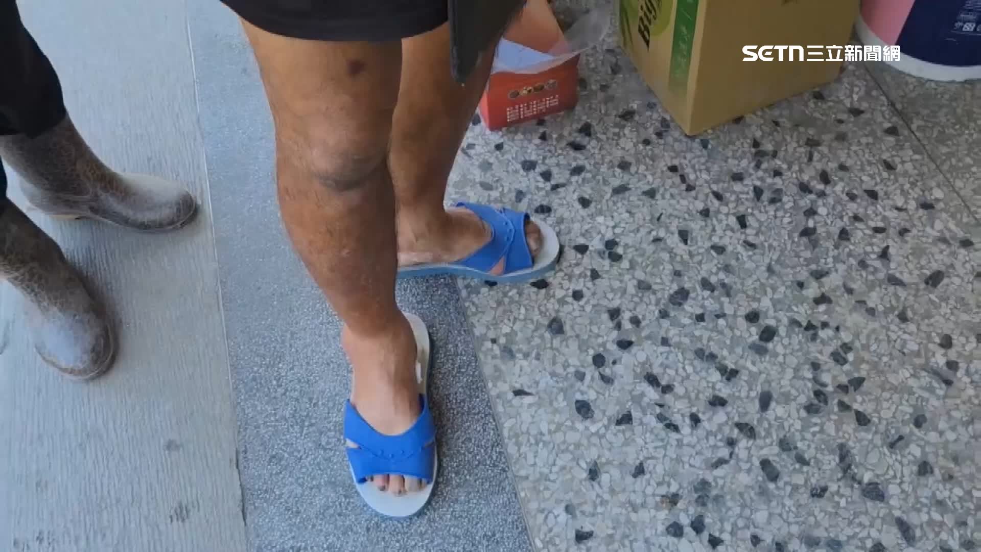 醫療站叮嚀如舊有傷口出現膿皰要定時回診換藥