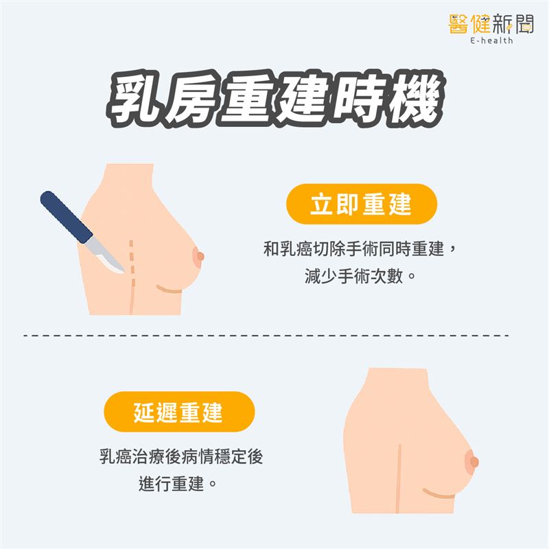 重建限制條件與時機。（圖／醫健新聞網提供）