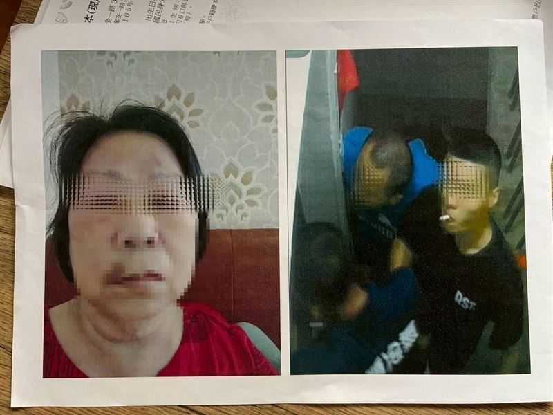 模範母親阿芸姨獨力照顧精障女兒慘遭惡少毆打斷牙，求救無門哭斷腸。（圖／《愛的延續》公益協會提供）