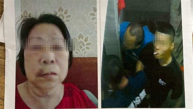 獨家/模範母親獨力顧女慘遭惡少毆打斷牙