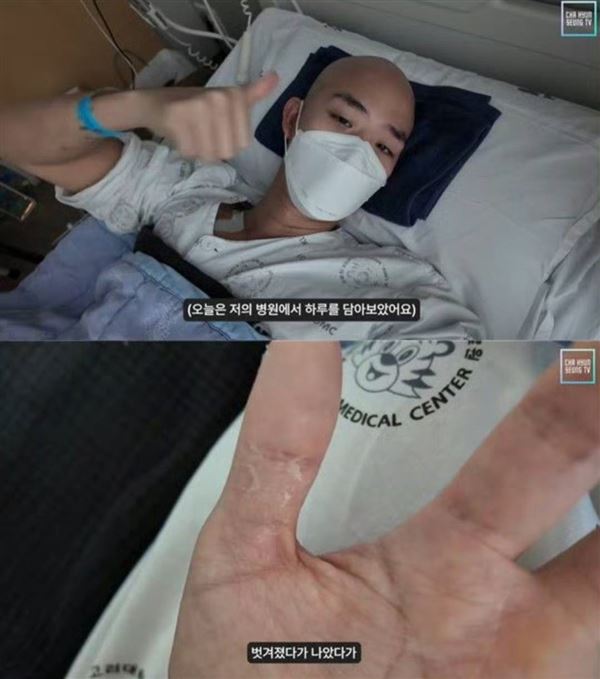 車炫承公開抗癌近況。（圖／翻攝自YouTube）