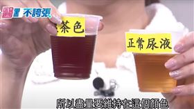 尿液。（圖／翻攝自節目祝你健康）