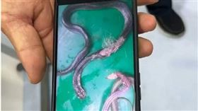 大陸廣東一名62歲男子被蛇咬傷，一氣之下把蛇打死，帶著蛇的屍體就醫，經治療後身體無大礙。（圖／翻攝自微博）