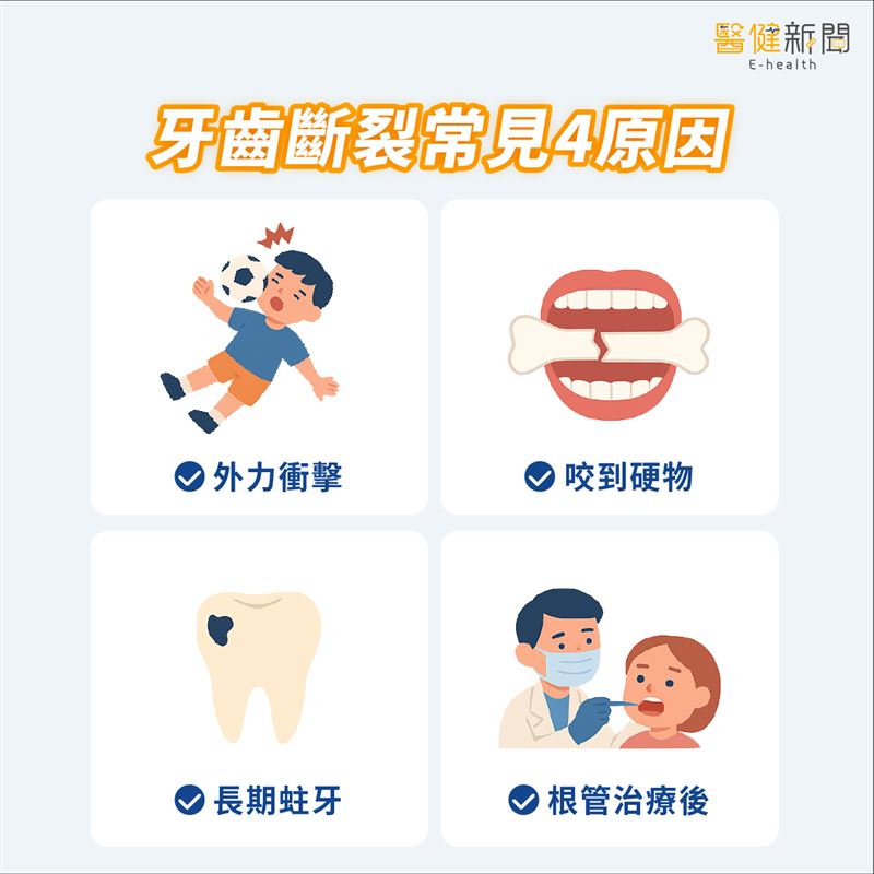 造成牙齒斷裂的4個常見原因(圖/醫健新聞網提供)