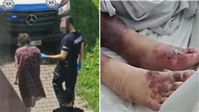 米雷拉遭囚27年終於解脫，但健康狀況極差，甚至腿部還有傷口見骨。（圖／翻攝自Pomagan.pl)）