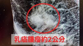 乳房,乳頭,乳癌,中醫大,乳暈（圖／中醫大新竹附醫提供）