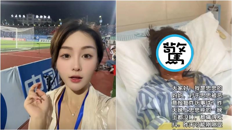 正妹網紅打開包裹是炸彈　臉炸傷毀容住院