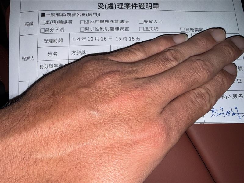 前中職球星方昶詠遭網友攻擊「假球腿」、「還沒死」，他前往警局報案提告，表示對惡意攻擊與誹謗零容忍。 （圖／翻攝自方昶詠臉書）