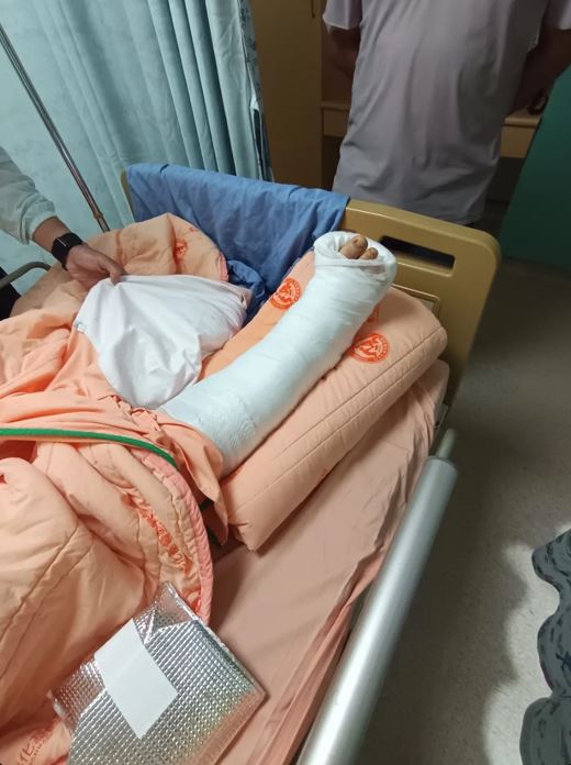 國中生與女遊客玩溜滑梯時，因下滑速度太快，分別造成腳踝骨折、左手骨折。(圖上／翻攝自Threads@_.iozu，圖下／翻攝畫面)