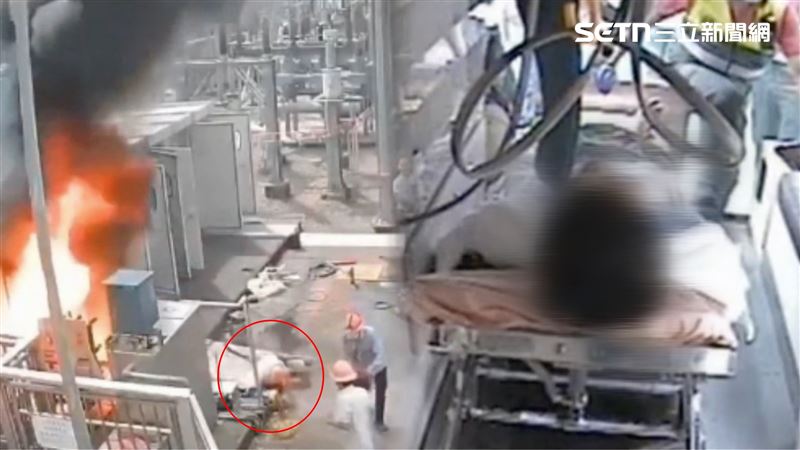 電廠爆炸1人「褪皮、四肢焦」！台電證實