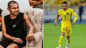 馬來西亞足球球星哈林去年被潑硫酸，渾身是傷（左圖）。如今他已順利復出（右圖）。（圖／翻攝自哈林X、臉書）