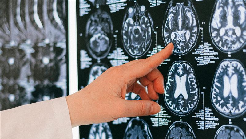 UCLA一項最新研究指出,女性體內負責調控大腦免疫反應的「KDM6A基因」活性,是男性的兩倍。(示意圖/pexels)