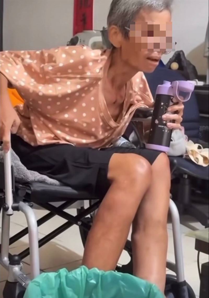 婉晴母親臉頰凹陷、骨瘦如柴，狀態相當憔悴。（圖／翻攝自Instagram）