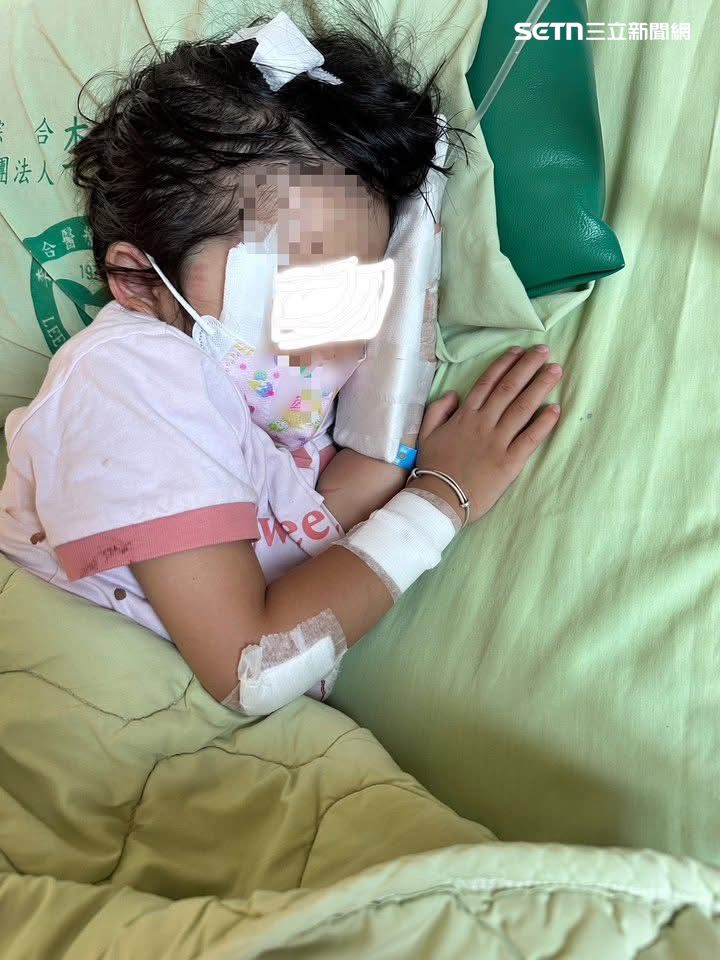 女童躺在床上驚魂未定，全身也多處咬傷。(圖/翻攝畫面)
