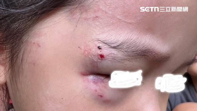 三義瘋狗咬3女童！店家澄清：不是我養的