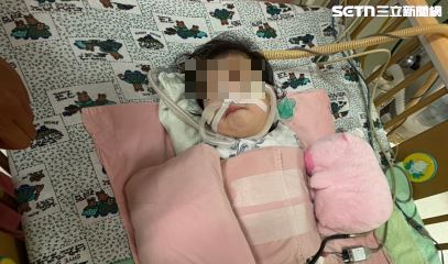 小女孩一度命危。（圖／胡栩菲授權提供，未經同意請勿轉載）