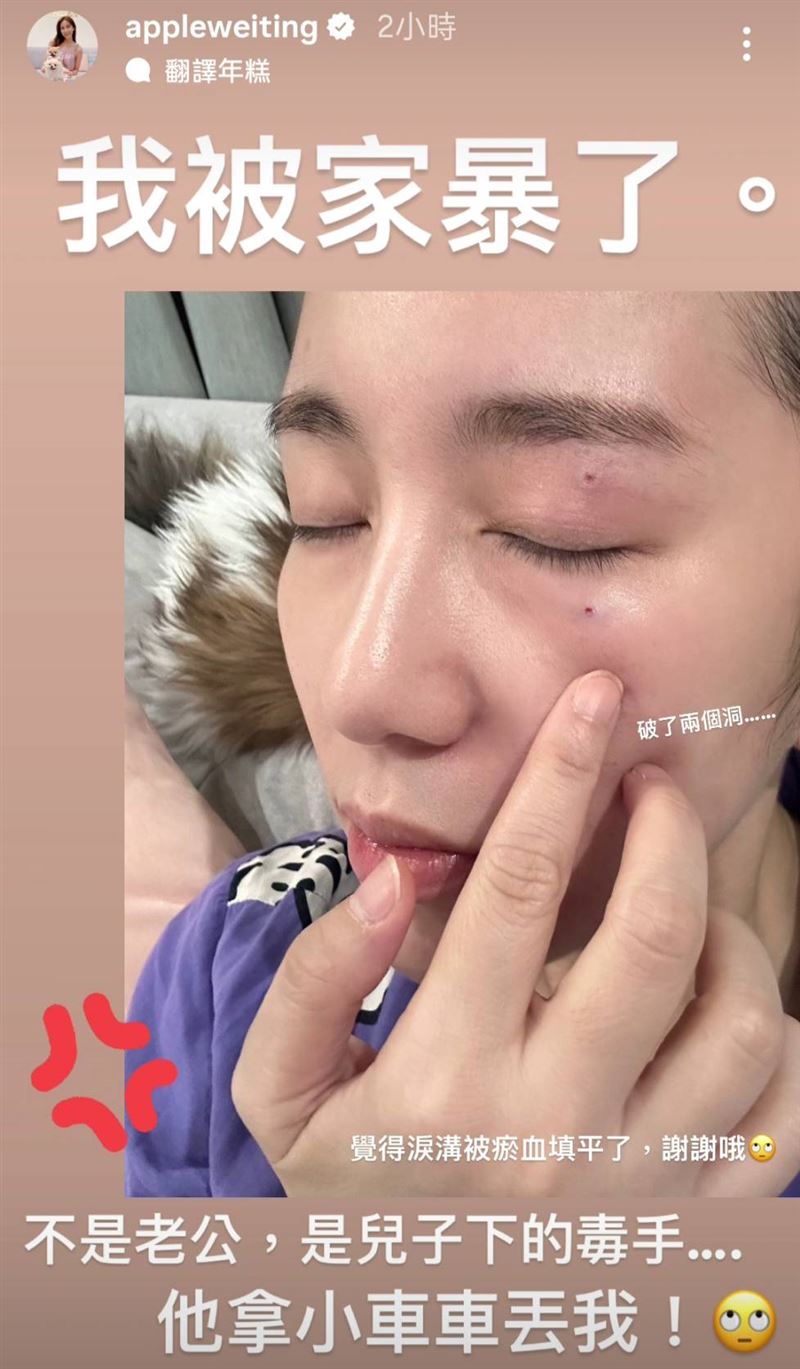 Apple被兒子用玩具車砸臉。（圖／翻攝自Apple IG）