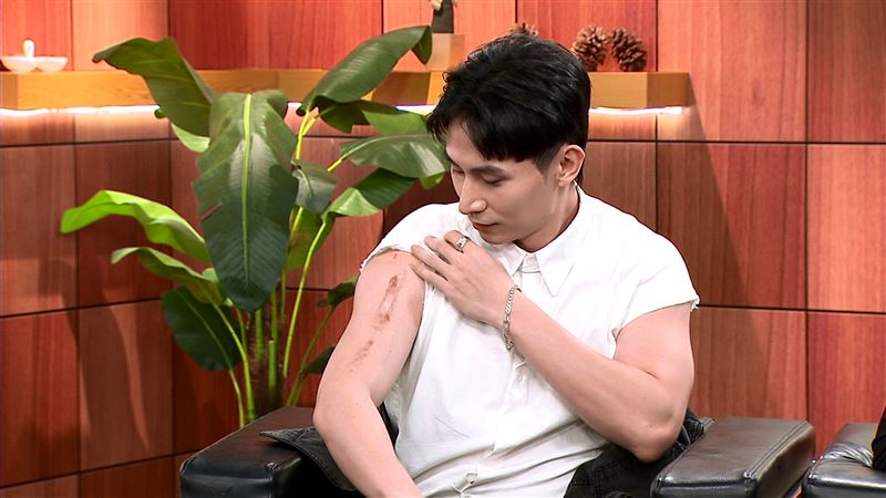 林家佑開刀後在手臂留下20公分疤痕。(圖／年代提供)