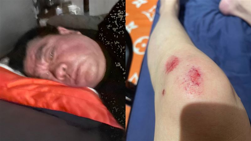 力挺于朦朧才逃過死期　孫德榮4天連摔3次