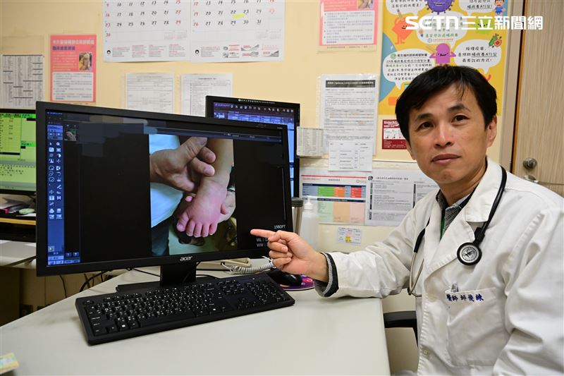只要出現持續高燒不退、抽血顯示強烈發炎反應,或心臟超音波出現冠狀動脈變化,醫療團隊就需高度懷疑並及時治療。(圖/翻攝畫面)
