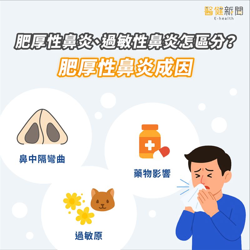 肥厚性鼻炎?與過敏性鼻炎怎麼區分?肥厚性鼻炎成因。(圖/醫健新聞網提供)