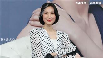 坣娜驚傳病逝？飽受紅斑性狼瘡皮膚像火燒