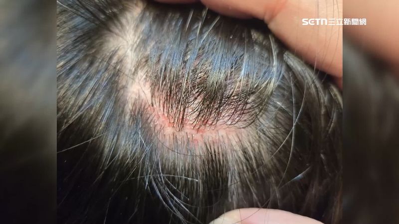 住戶遭勒脖，頭著地腦震盪