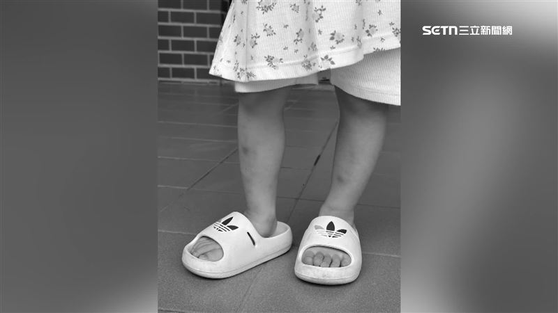 虐害4歲女童終身殘！禮儀師竟傳:快來滅證