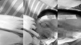 嘉義,男童,黑犬,攻擊撕咬,動保法,臉部撕裂傷。（圖／翻攝畫面）