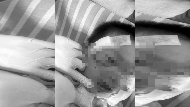 嘉義男童遭黑犬撲倒狂啃！臉部嚴重撕裂傷