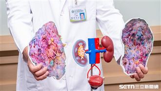 切除6公斤多囊腎　她捐腎移植救補教師姊