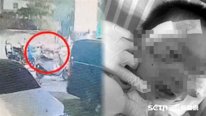 畫面曝！神明祝壽…中邪狗扯咬單親童毀容