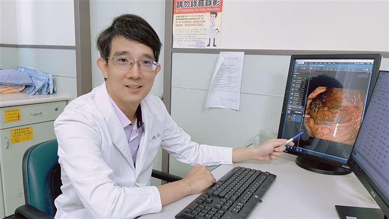 遺傳讓大腸塞滿數百顆瘜肉　男全大腸切除