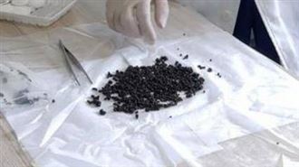 醫師揭膽結石3大因子　「1職業」要小心