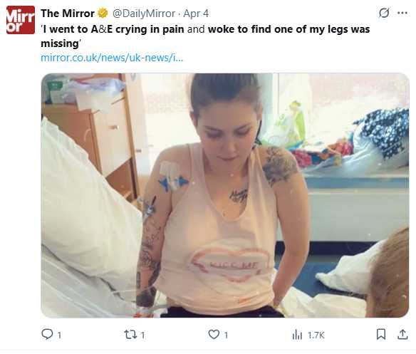 英國一名26歲護理師因腿部麻木、變色,緊急送醫,沒想到院方卻延誤治療16個小時,等到護理師手術醒來後,發現自己已經失去一條腿。(圖/翻攝自X)