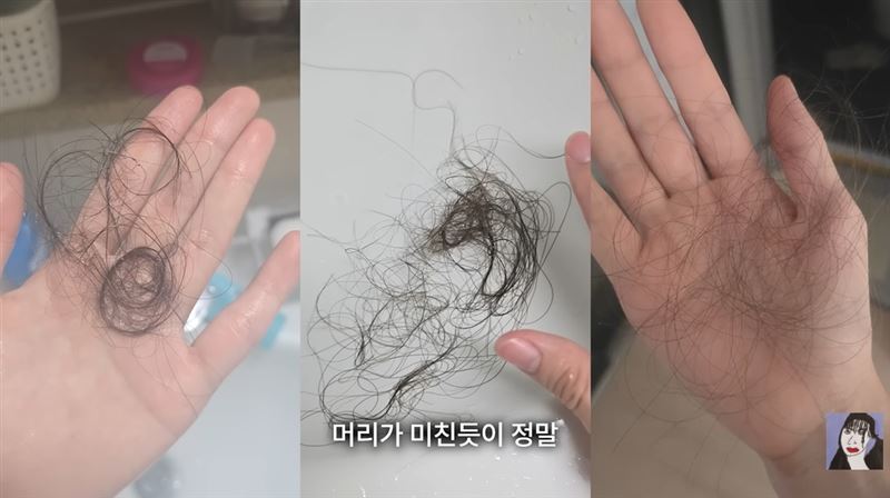 長期壓力與創傷讓郭赫秀身心俱疲，連掉髮都變得很嚴重。（圖／翻攝自곽혈수 YT）