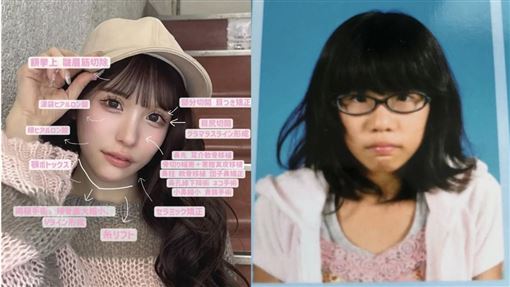 女星花2600萬變臉　對比照獲讚：非常努力