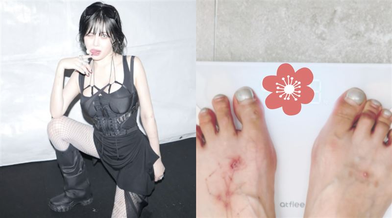 南韓女星泫雅9日在澳門表演時，突在舞台上暈倒，嚇壞全場觀眾。（圖／翻攝自IG）