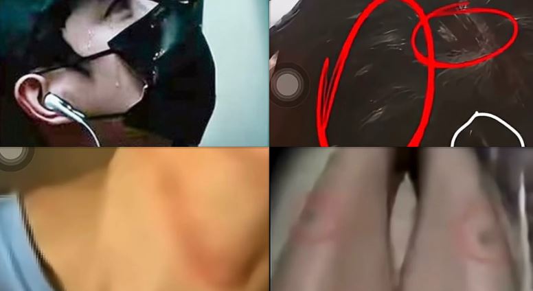 于朦朧生前體重暴瘦、臉頰凹陷，身上疑似出現毆打痕跡。（圖／翻攝自TikTok）